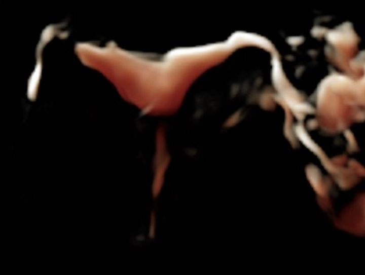HYFOSY ExEm foam 3D prohodnost jajovoda